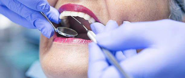 Best Emergency Root Canal Treatment in Langley, WA